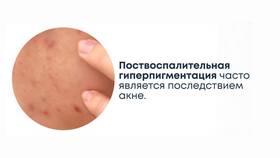 Как легко вывести различные виды пятен в Аптека Невис