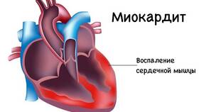 ООО сердца у детей: что это означает в Аптека Невис